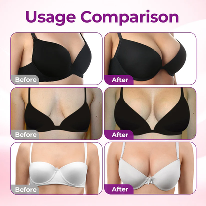 🎁 Alcuras® Targeted Breast Enhancement Advanced Nano Microneedle Patch
