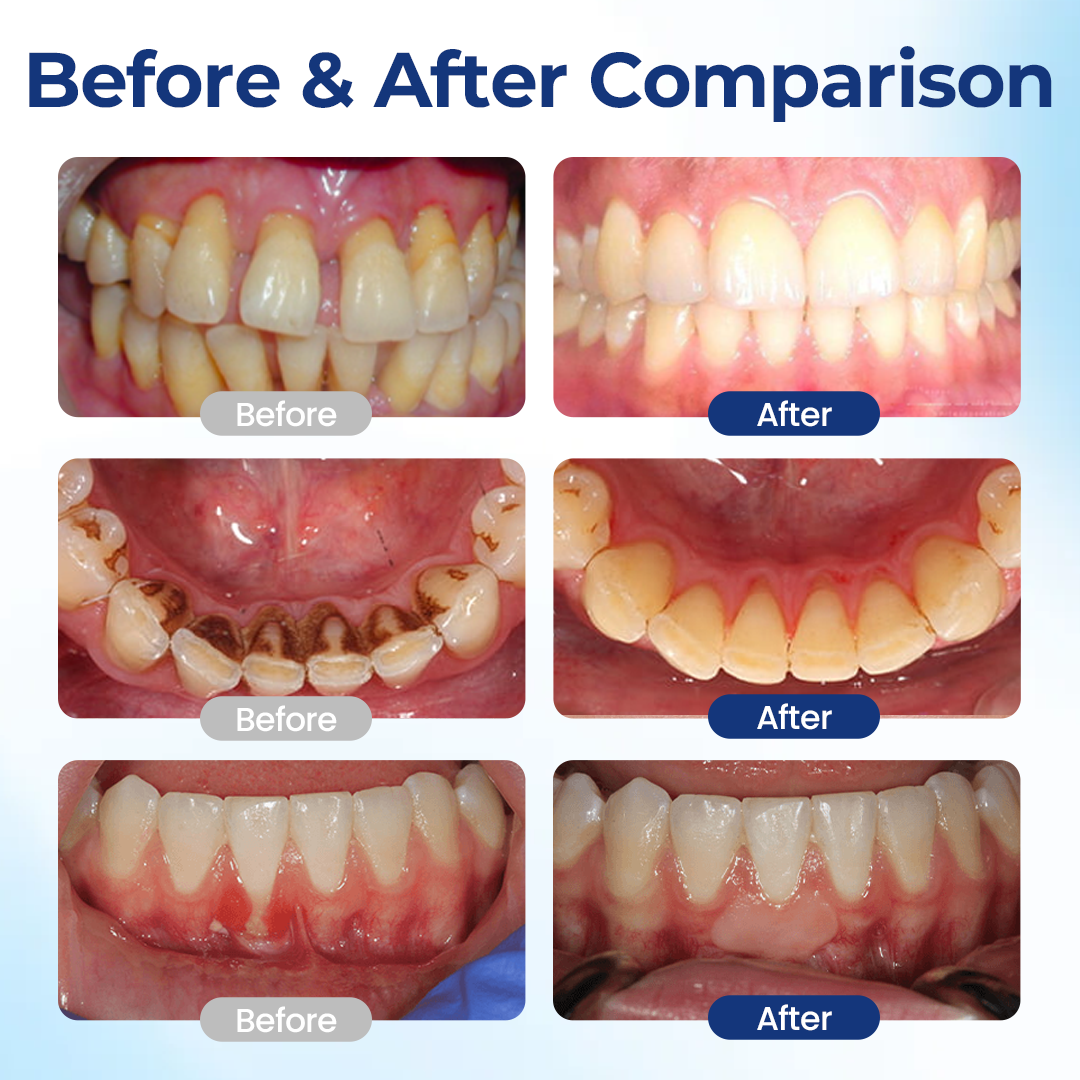 Alcuras® BeeTakt Oral Repair Solution