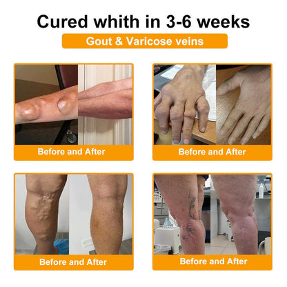 Alcuras™ Botulinum Toxin & Bee Venom Pain-Relief Bone Healing Cream🐝💎